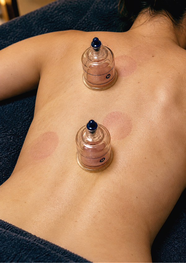 cupping-photo-1